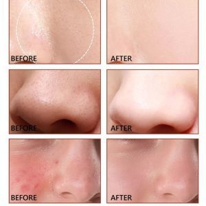 سرم درمان منافذ باز پوست گلامور حجم 30 میل GLAMOUR