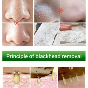 محلول از بین برنده جوش سر سیاه بینی برند بریلی (STEP 1)