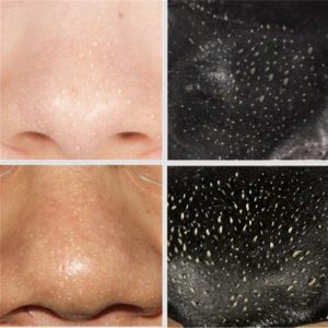 ماسک سیاه ب