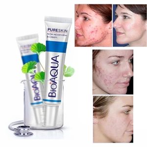 کرم ضد جوش بیواکوا مدل Pure Skin حجم 30 میلی لیتر