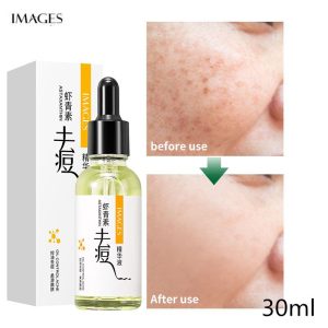 سرم ضد جوش و ضد آکنه آستاگزانتین ایمیجز حجم 30 میلی لیتر