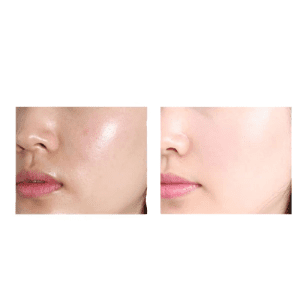 سرم مرطوب کننده صورت جومتام عصاره هیالورونیک اسید حجم ۴ میلی لیتر