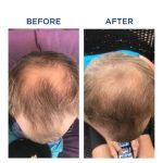 کپسول فیتو فانر